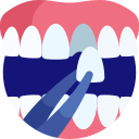 Carillas Dentales