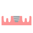 Implante Dental
